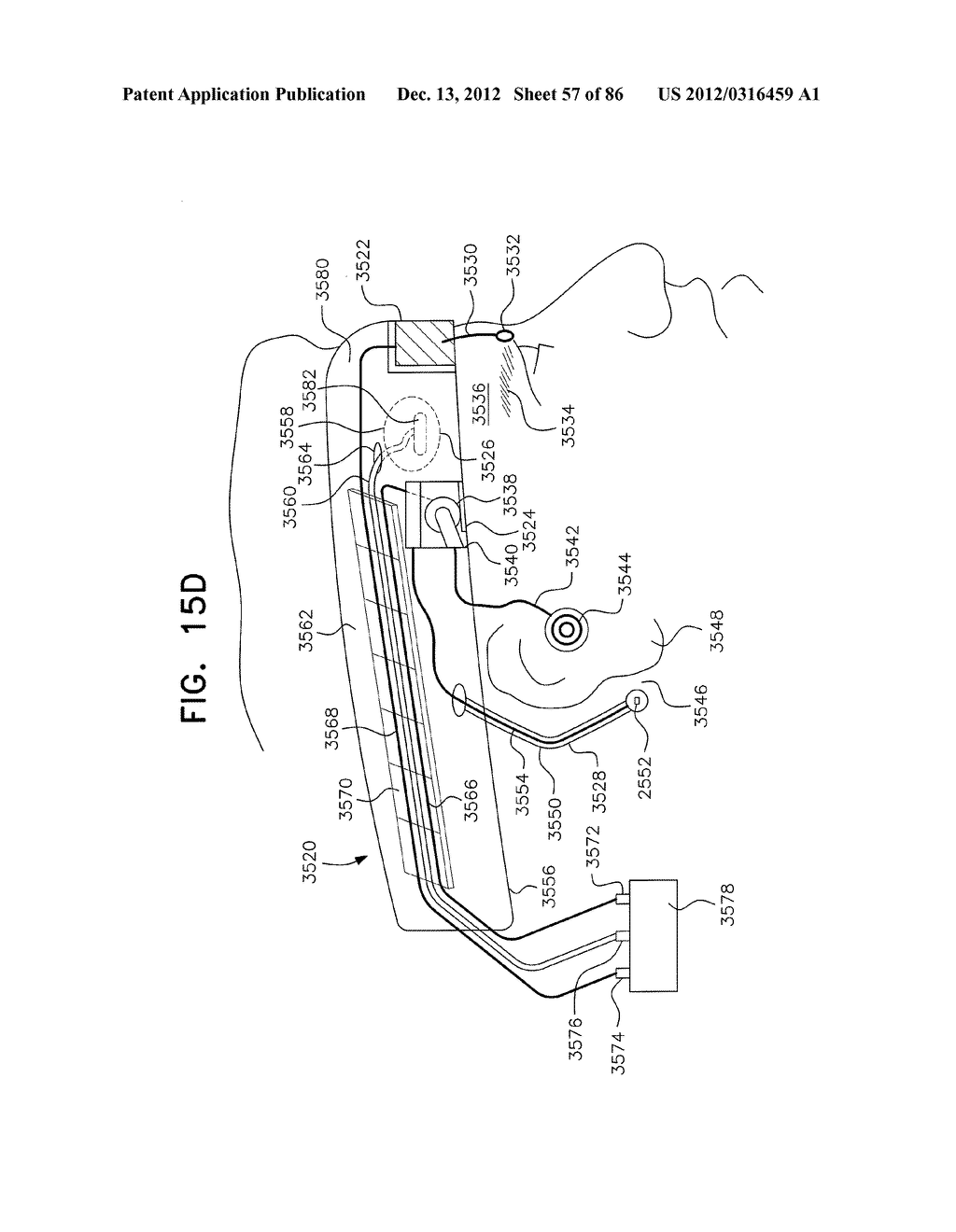 APPARATUS AND METHOD FOR MEASURING BIOLOGIC PARAMETERS - diagram, schematic, and image 58