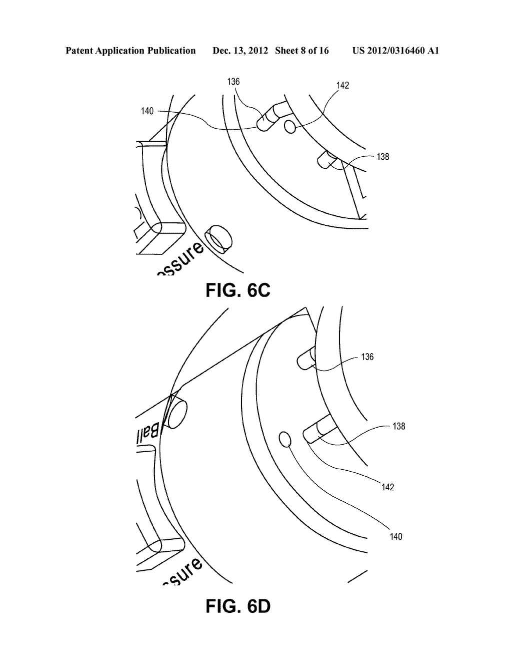 FLUID DELIVERY SYSTEM WITH PRESSURE MONITORING DEVICE - diagram, schematic, and image 09