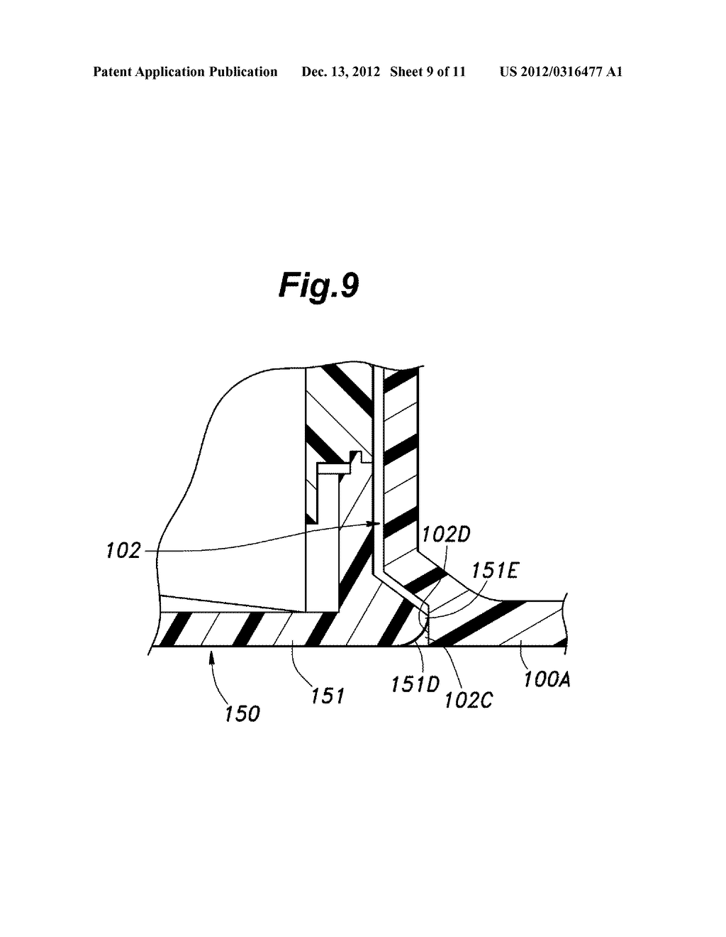 BATTERY PACK ENCASING STRUCTURE AND WALKING ASSISTANCE DEVICE USING SAME - diagram, schematic, and image 10