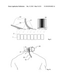 SURGICAL ACCESS DEVICE diagram and image