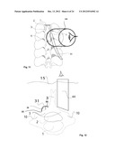 SURGICAL ACCESS DEVICE diagram and image