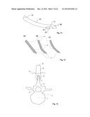 SURGICAL ACCESS DEVICE diagram and image