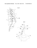 SURGICAL ACCESS DEVICE diagram and image