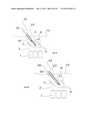 SURGICAL ACCESS DEVICE diagram and image