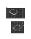 SURGICAL ACCESS DEVICE diagram and image