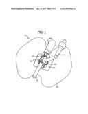 MEDICAL TUBING SECUREMENT ASSEMBLY AND METHODS OF USE diagram and image