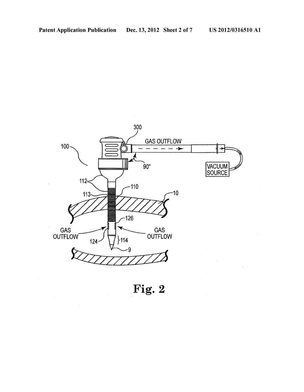 DEVICE AND METHOD FOR EVACUATING SURGICAL VAPOR AND MIST FROM A BODY     CAVITY - diagram, schematic, and image 03