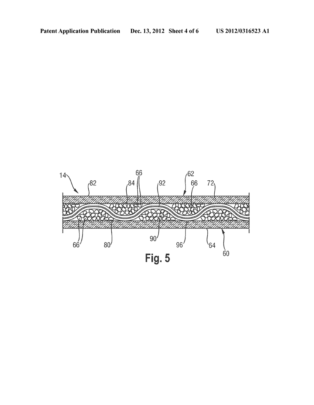 Disposable Diaper Having Reduced Absorbent Core to Backsheet Gluing - diagram, schematic, and image 05