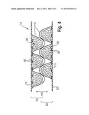 Laminate Absorbent Core for Use in Absorbent Articles diagram and image