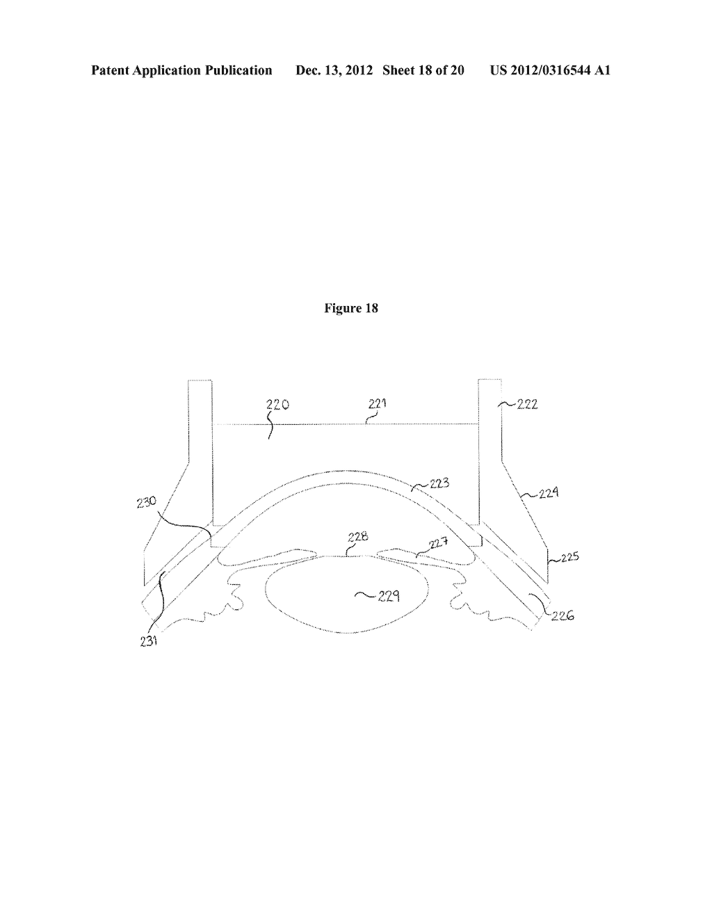 LASER DELIVERY SYSTEM FOR EYE SURGERY - diagram, schematic, and image 19