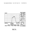 Treatment of Cellulite and Adipose Tissue with Mid-Infrared Radiation diagram and image