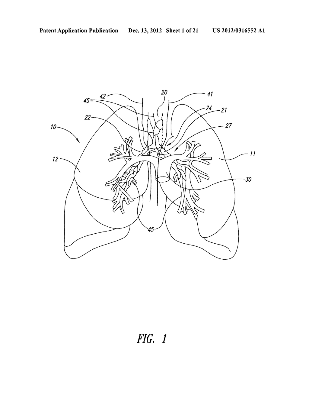 SYSTEMS, ASSEMBLIES, AND METHODS FOR TREATING A BRONCHIAL TREE - diagram, schematic, and image 02