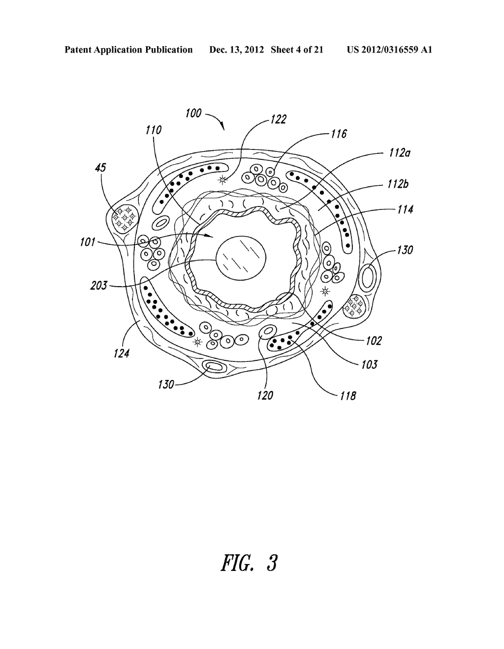 SYSTEMS, ASSEMBLIES, AND METHODS FOR TREATING A BRONCHIAL TREE - diagram, schematic, and image 05