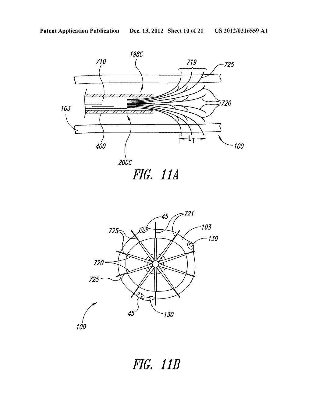 SYSTEMS, ASSEMBLIES, AND METHODS FOR TREATING A BRONCHIAL TREE - diagram, schematic, and image 11
