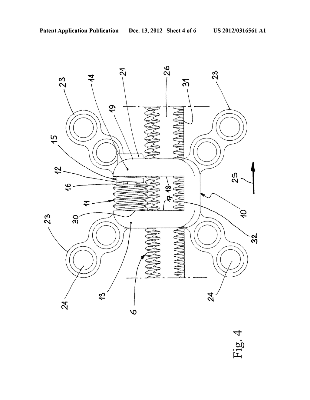 CUSTOMIZED INTRAORAL JAW DISTRACTOR AND USE OF SUCH A DISTRACTOR IN ORDER     TO OBTAIN ALMOST CONTINUOUS DISTRACTION - diagram, schematic, and image 05