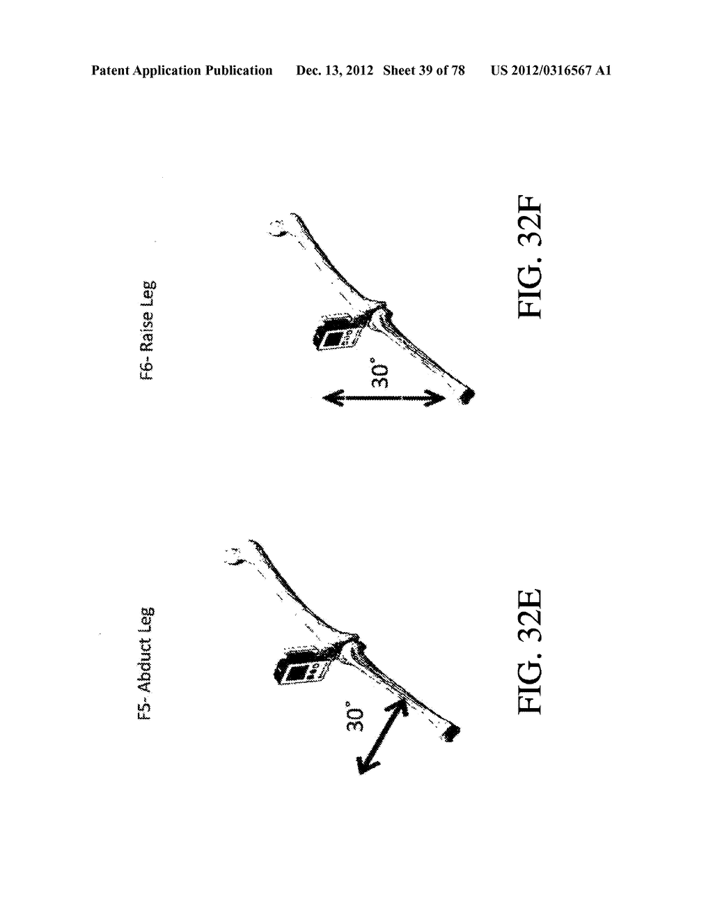 SYSTEMS AND METHODS FOR JOINT REPLACEMENT - diagram, schematic, and image 40