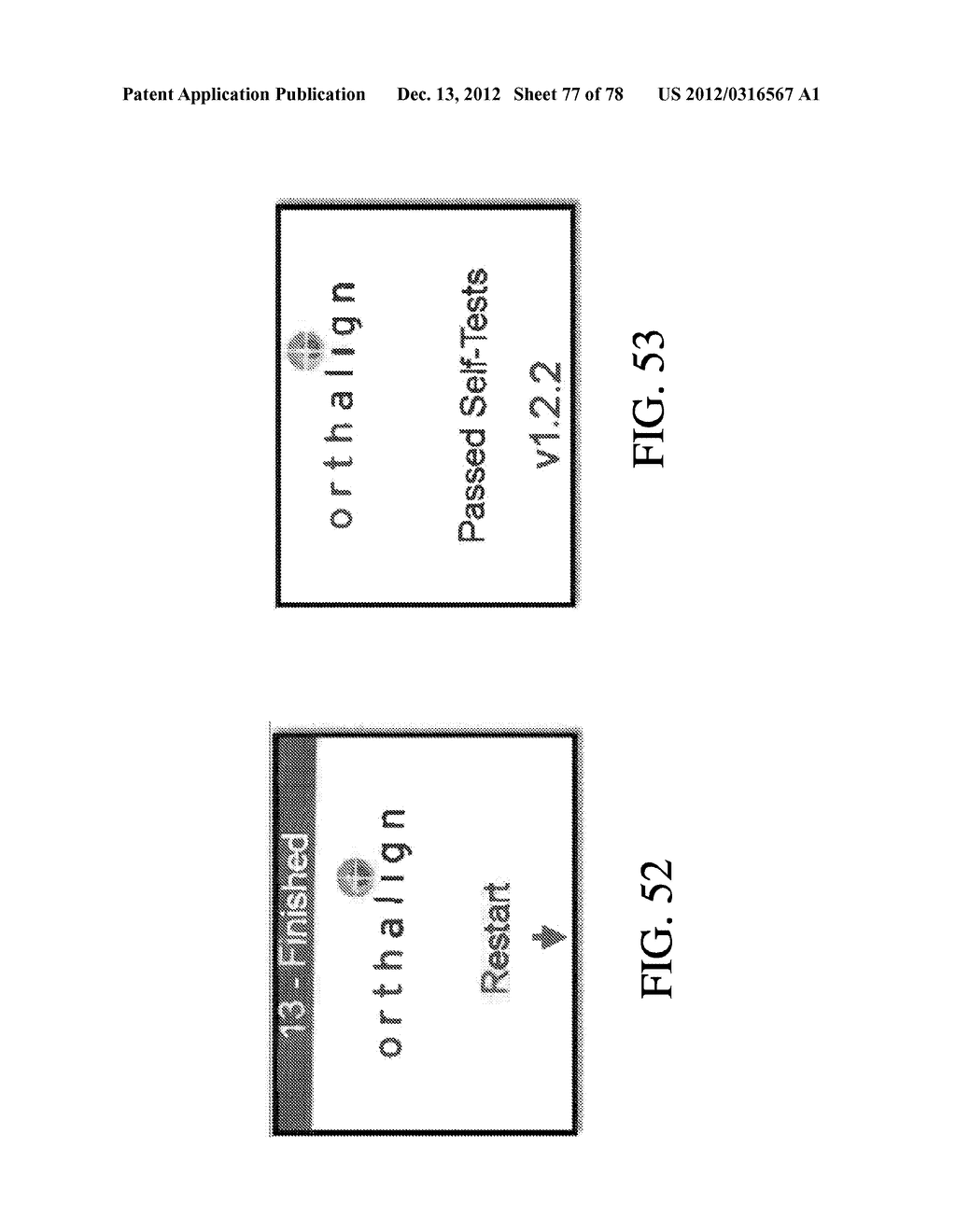 SYSTEMS AND METHODS FOR JOINT REPLACEMENT - diagram, schematic, and image 78