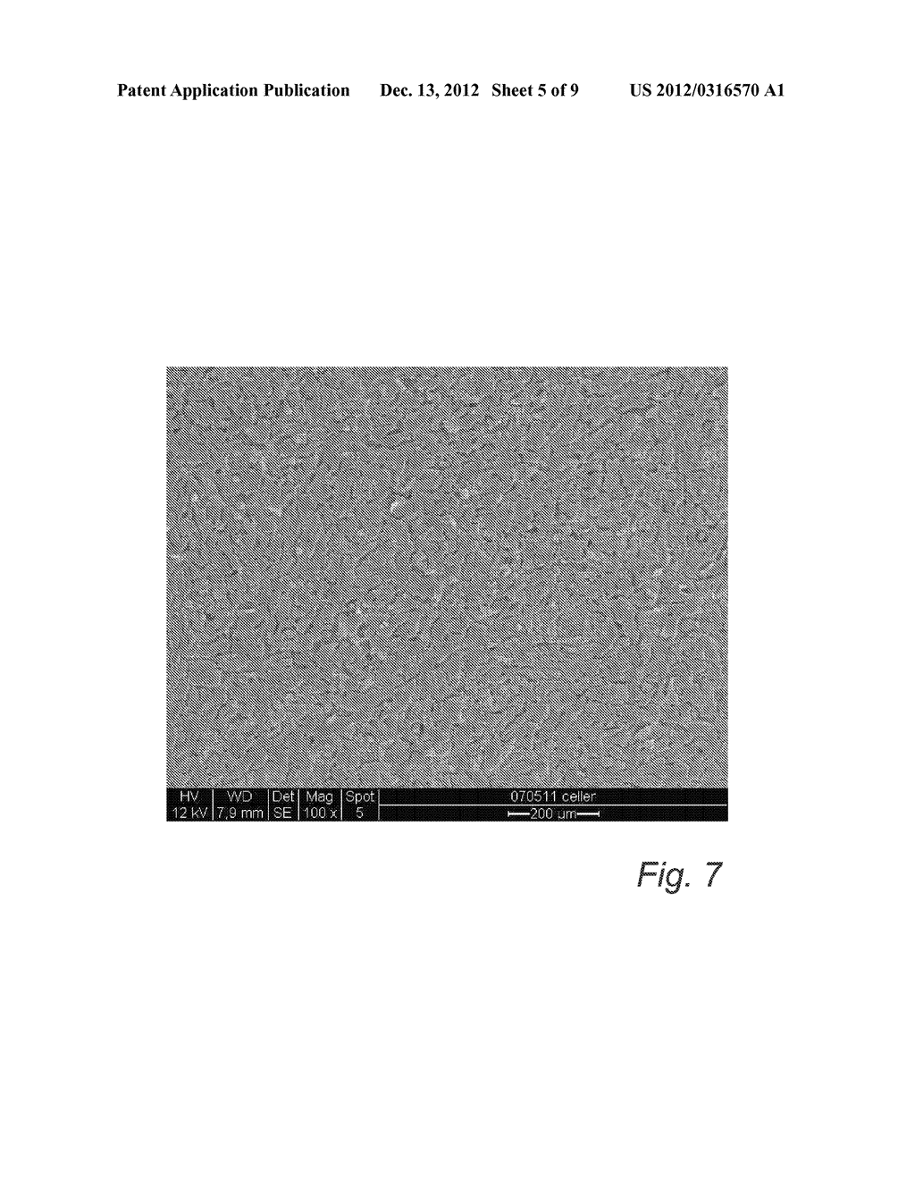 BONE TISSUE IMPLANT COMPRISING STRONTIUM IONS - diagram, schematic, and image 06