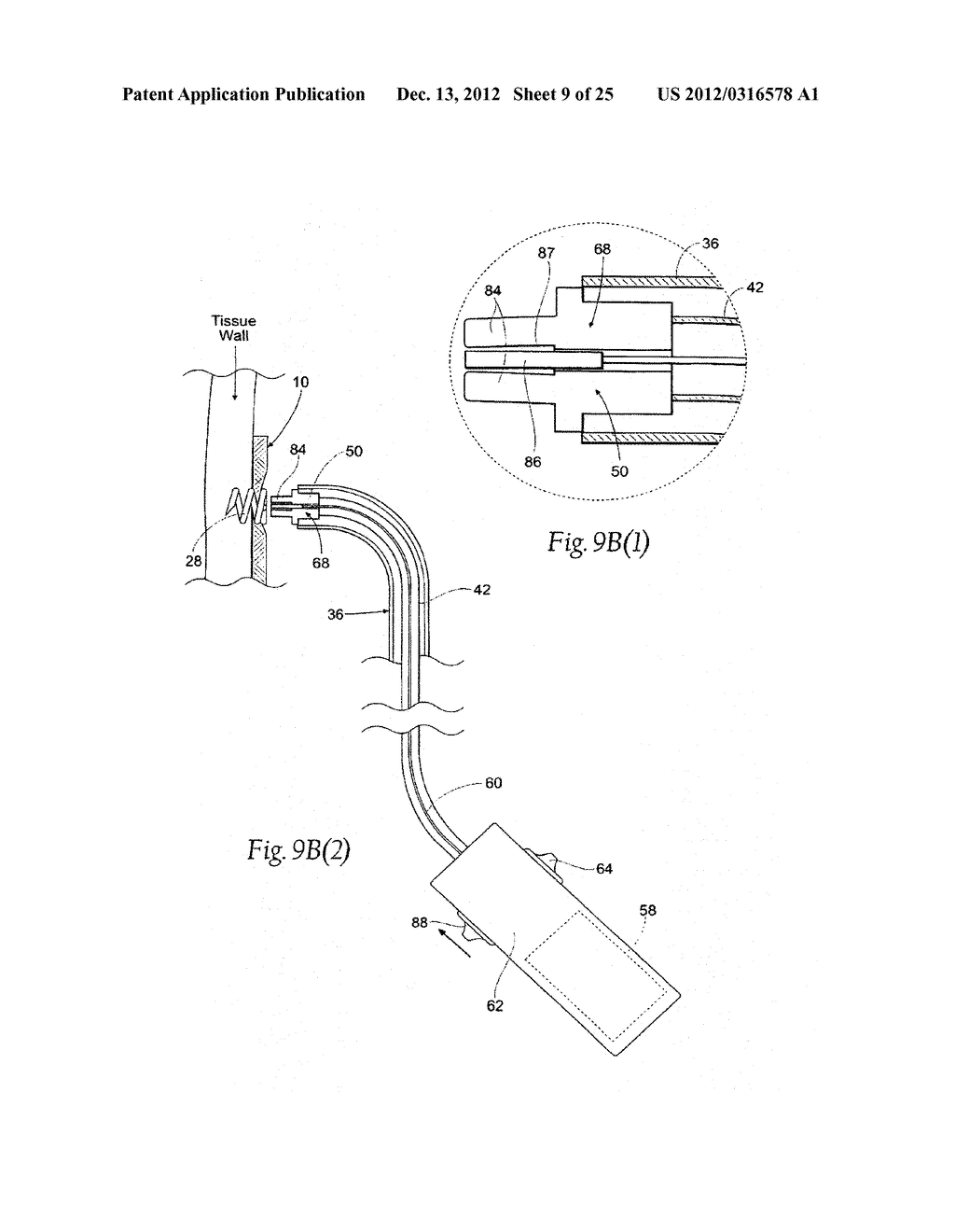 SYSTEMS AND METHODS FOR ATTACHING A PROSTHESIS WITH A BODY LUMEN OR HOLLOW     ORGAN - diagram, schematic, and image 10