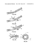 ARTICULATING SUTURING DEVICE AND METHOD diagram and image