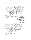 ARTICULATING SUTURING DEVICE AND METHOD diagram and image