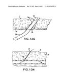 ARTICULATING SUTURING DEVICE AND METHOD diagram and image