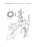 ARTICULATING SUTURING DEVICE AND METHOD diagram and image