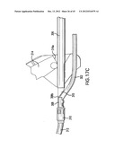 ARTICULATING SUTURING DEVICE AND METHOD diagram and image