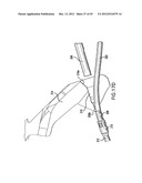 ARTICULATING SUTURING DEVICE AND METHOD diagram and image