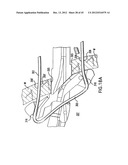 ARTICULATING SUTURING DEVICE AND METHOD diagram and image