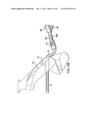 ARTICULATING SUTURING DEVICE AND METHOD diagram and image