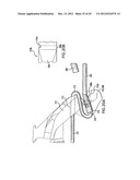 ARTICULATING SUTURING DEVICE AND METHOD diagram and image