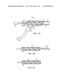 MECHANICAL PUMP FOR REMOVAL OF FRAGMENTED MATTER AND METHODS OF     MANUFACTURE AND USE diagram and image