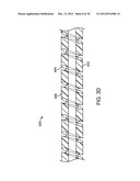 MECHANICAL PUMP FOR REMOVAL OF FRAGMENTED MATTER AND METHODS OF     MANUFACTURE AND USE diagram and image