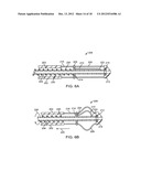 MECHANICAL PUMP FOR REMOVAL OF FRAGMENTED MATTER AND METHODS OF     MANUFACTURE AND USE diagram and image