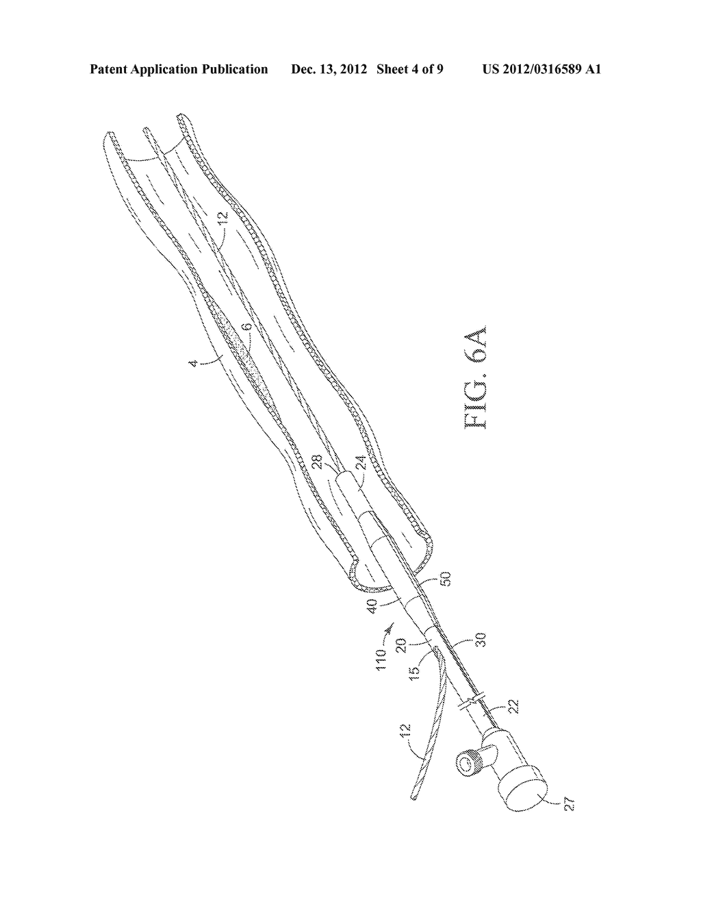 Balloon catheter with raised elements and visual marker - diagram, schematic, and image 05