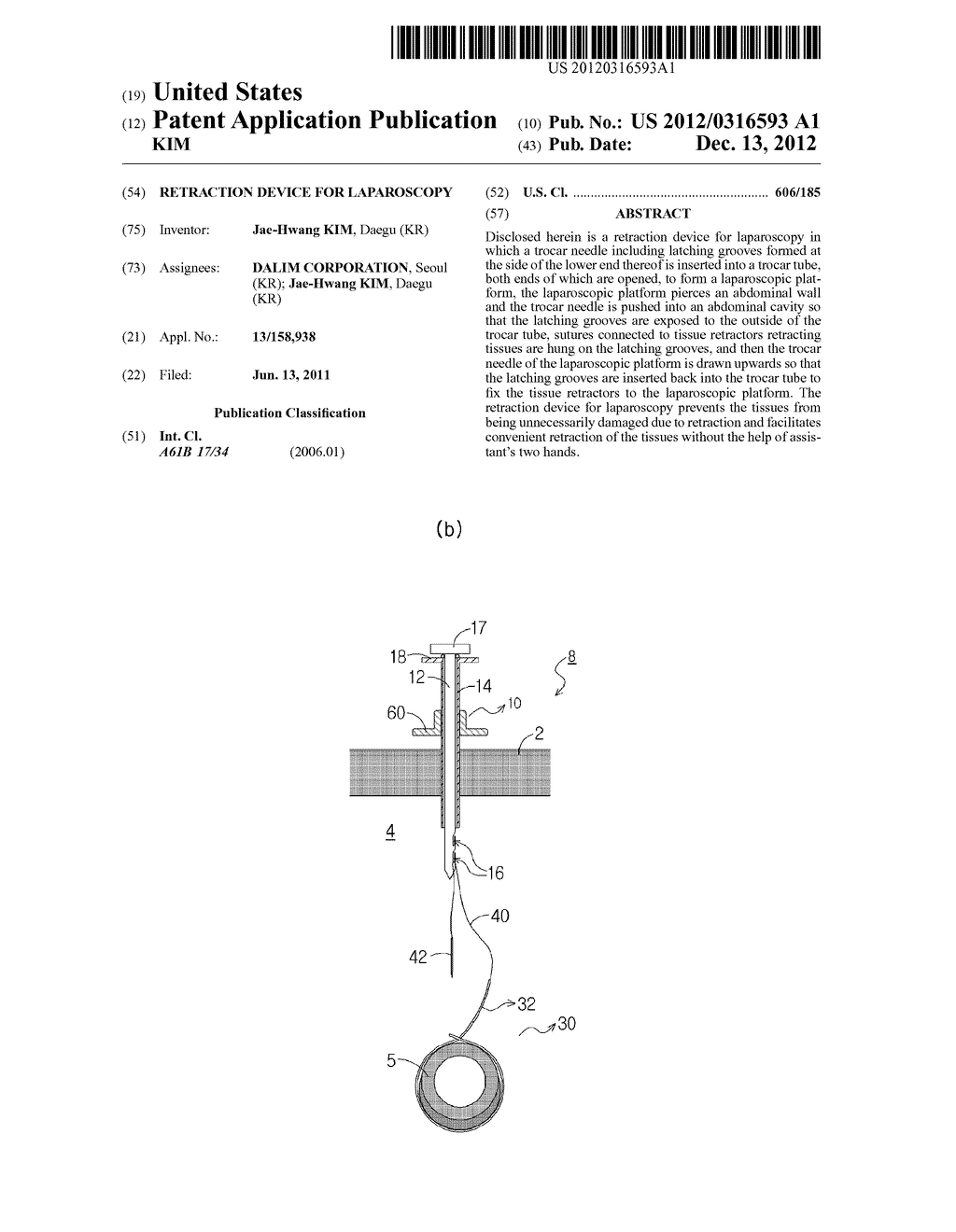 RETRACTION DEVICE FOR LAPAROSCOPY - diagram, schematic, and image 01