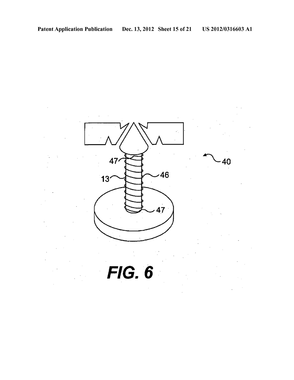 TISSUE FASTENING DEVICES AND PROCESSES THAT PROMOTE TISSUE ADHESION - diagram, schematic, and image 16