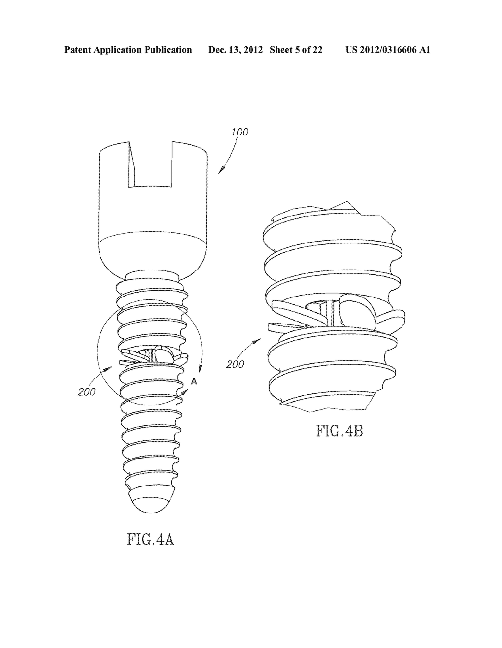 DEVICE FOR ENHANCED MECHANICAL STABILIZATION - diagram, schematic, and image 06