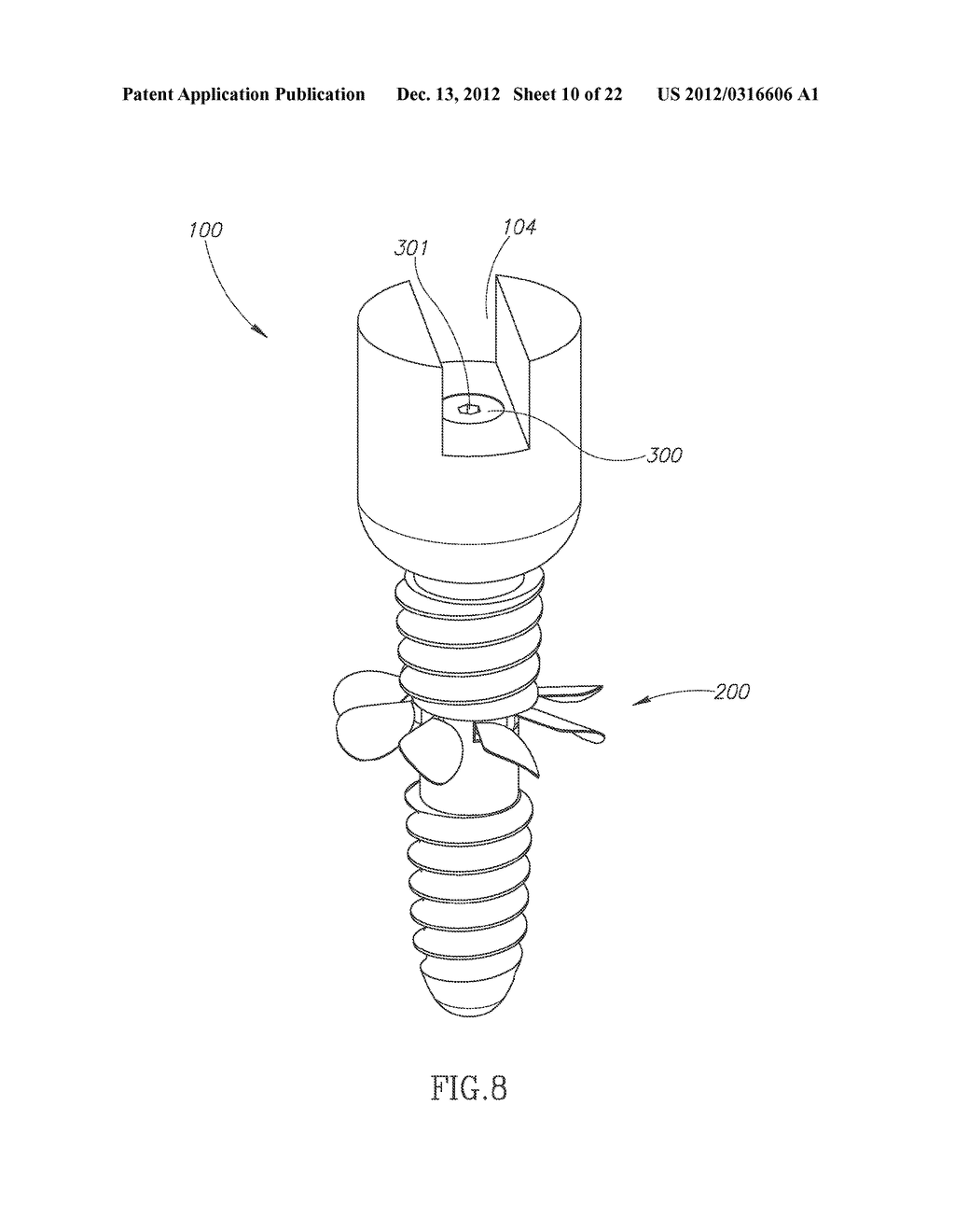 DEVICE FOR ENHANCED MECHANICAL STABILIZATION - diagram, schematic, and image 11