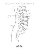 FLEXIBLE GUIDE WIRE diagram and image