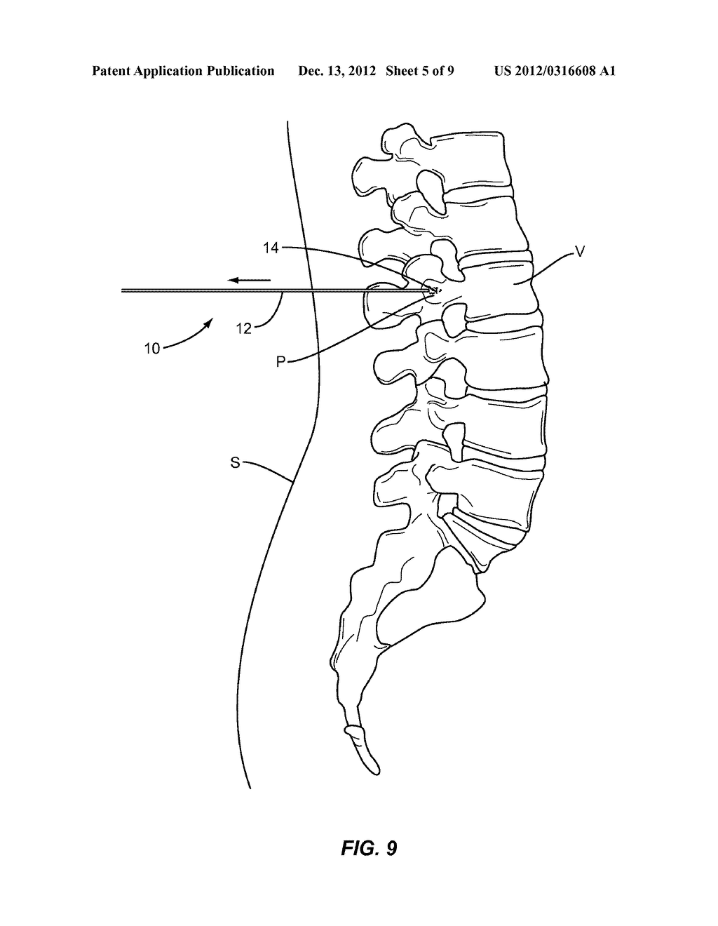 FLEXIBLE GUIDE WIRE - diagram, schematic, and image 06