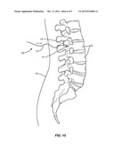 FLEXIBLE GUIDE WIRE diagram and image