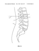 FLEXIBLE GUIDE WIRE diagram and image