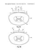 SYSTEMS AND METHODS FOR CUSTOMIZING STIMULATION USING IMPLANTABLE     ELECTRICAL STIMULATION SYSTEMS diagram and image