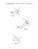 THERAPEUTICE DEVICE diagram and image