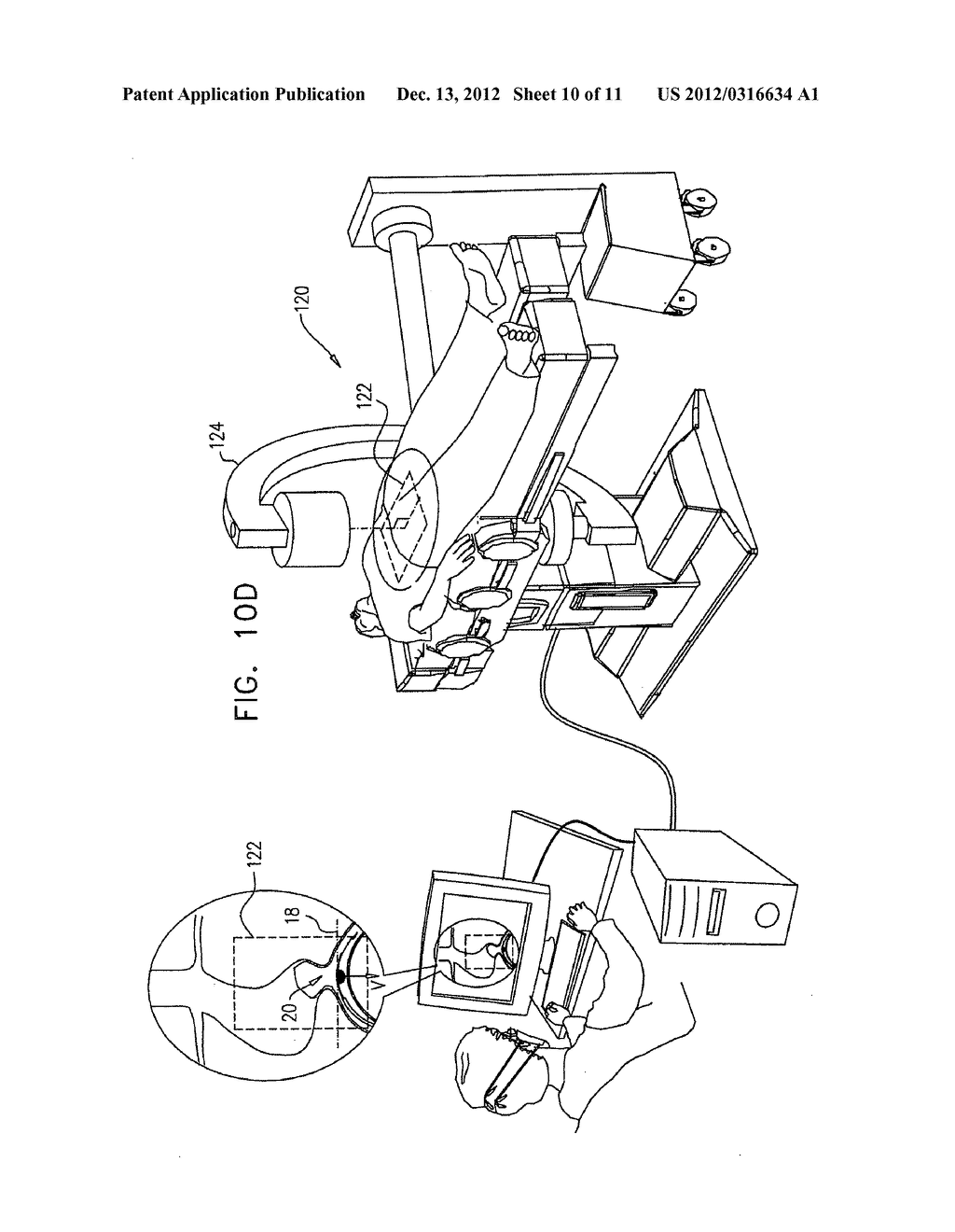 ENDOVASCULAR FLOW DIRECTION INDICATOR - diagram, schematic, and image 11