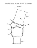 RESILIENT MEDICALLY INFLATABLE INTERPOSITIONAL ARTHROPLASTY DEVICE diagram and image