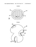 RESILIENT MEDICALLY INFLATABLE INTERPOSITIONAL ARTHROPLASTY DEVICE diagram and image