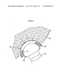 RESILIENT MEDICALLY INFLATABLE INTERPOSITIONAL ARTHROPLASTY DEVICE diagram and image